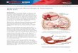 Subarachnoid Hemorrhage & Vasospasm basic levelucgardnerneuroscienceinstitute.com/wp-content/uploads/2013/01/PE... · CTA provides the best pictures of blood vessels ... abits and