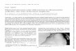 Manubriosternal arthritis: the role of thoracic kyphosisard.bmj.com/content/annrheumdis/45/4/345.full.pdf · kyphosis. arthritis: the role of thoracic dislocation in rheumatoid Manubriosternal