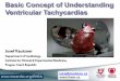 Basic Concept of Understanding ventricular tachycardias ...assets.escardio.org/.../kautzner-ventricular-tachycardias.pdf · • Ventricular Tachycardia (VT) - a tachycardia (rate