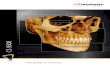 CS 9300 - Carestream new CS 9300 3D digital imaging system from Carestream Dental – take the guesswork
