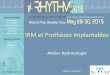 IRM et Prothèses Implantables - Rhythm congress 2017€¦ · interferences bruit ++++ frequence innapropriee mode secours (reset mode) inhibition stimulation dai : therapie innapropriee