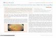 Harada Disease Versus Central Serous Corioretinopathymedcraveonline.com/AOVS/AOVS-02-00065.pdf · Advances in Ophthalmology & Visual System Harada Disease Versus Central Serous Chorioretinopathy