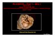 PLACENTA – Part 1 – BIG 4 - Department of Pathology · PLACENTA – Part 1 – BIG 4 ... (look at umbilical cord & vessels and chorionic plate vessels) ... Increased risk related