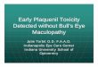 Early Plaquenil Toxicity Detected without Bull’s Eye ... Toxicity... · Early Plaquenil Toxicity