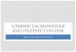 UTERINE TACHYSYSTOLE AND ITS EFFECT ON EFM · •First stage: MVU’s- 100-250, frequency of 3-5 every 10 min •Second stage: MVU’s 300-400; ctx frequency of 5-6 every 10 min