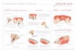 Preparation Guide: anterior remier - Premier Dental … · dental studios Preparation Guide: posterior premier all - ceramic 1.5-mm axial reduction A flat-ended tapered diamond bur