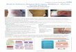 Medical Adhesive Related Skin Injury (MARSI) in … · Medical Adhesive Related Skin Injury (MARSI) in Vascular Access Devices Jan Hitchcock & Louise Savine Vascular Access & Tissue