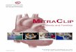 MitraClip - A Guide for Patients and Families · A Guide for Patients and Families MitraClip ... If this is the case, ... surgery are also considered for the MitraClip procedure because