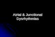 Atrial & Junctional Dysrhythmias - Miami County EMS · Atrial & Junctional Dysrhythmias Atrial zPremature Atrial ... Not a common dysrhythmia. ... atrial fibrillation or flutter z
