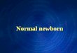 Normal newborn - WordPress.com · 2014-10-13 · Normal newborn. objectives Quickly ... Newborn examination indications ... Part of general examination