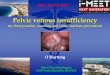 Pelvic venous insufficiency - MEET CONGRESSmeetcongress.com/pdf/presentation-2017/thursday/Thursday-1650... · Pelvic venous insufficiency All manifestations due to pelvic venous