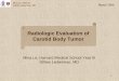 Radiologic Evaluation of Carotid Body Tumoreradiology.bidmc.harvard.edu/LearningLab/central/Le.pdf · Radiologic Evaluation of. Carotid Body Tumor. Mina Le, Harvard Medical School