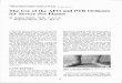 The Use of the AFO and PTB Orthoses for Severe Pes Planus · The Use of the AFO and PTB Orthoses for Severe Pes Planus by Gustav Rubin, M.D., F.A.C.S. Malcolm Dixon, M.A., R.P.T