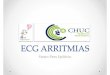 3º curso cardiologia pediatrica - ECG arritmias · • RS normal • Taqui Sinusal – ECG normal + taqui • Bradi Sinusal – ECG normal + bradi • Arritmia Sinusal Respiratória
