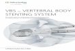 VBS – VERTEBRAL BODY STENTING SYSTEMsynthes.vo.llnwd.net/o16/LLNWMB8/INT Mobile/Synthes International... · VBS bietet einzigartige Vorteile für Patienten und Ärzte: Perkutan