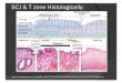 Enlarged raisin-like nuclei + perinuclear halo · + perinuclear halo In any HPV lesion . nuclear enlargement, hyperchromasia (dark staining), coarse chromatin granules, and variation