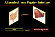 Alterazioni asse Fegato - Intestino Slide #2 · Slide #9 From DL Wyles, MD, ... infiammazione del colon e in forma più lieve rispetto ai pazienti senza PSC 3. > incidenza di displasia