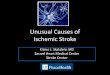 Unusual Causes of Ischemic Stroke - PeaceHealth · Unusual Causes of Ischemic Stroke Elaine J. Skalabrin MD ... • Stroke is the fourth leading cause of death in America and a leading