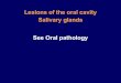 Lesions of the oral cavity Salivary glands See Oral pathology · abdomen (confusing appendicitis),