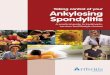 Taking control of your Ankylosing Spondylitis · 4 Taking control of your Ankylosing Spondylitis What is ankylosing spondylitis? Ankylosing spondylitis is a disease which causes inflammation