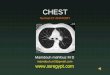 CHEST · CHEST Normal CT ANATOMY Mamdouh mahfouz M D mamdouh.m5@gmail.com