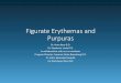 Figurate Erythemas and Purpuras - cdn.ymaws.com · •Dermatophytes (Tinea Pedis) •Fungal: Candida, Penicillium in blue cheese. •Viruses (e.g. poxvirus, EBV, varicella-zoster