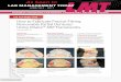 How to Fabricate Precise-Fitting Removable Partial ... · As Seen In LMT • June/July 2017 • 42 How to Fabricate Precise-Fitting Removable Partial Dentures Using Ultaire™ AKP