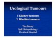 urology cancers PMS - .Urological tumours RCC - Epidemiology! 3% of adult malignancies, RCC makes