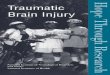 Traumatic Brain Injury - storage.googleapis.com · 1 Introduction Traumatic brain injury (TBI) is a major public health problem, especially among male adolescents and young adults