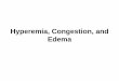 Hyperemia, Congestion, and Edema - life.illinois.edu · TABLE 4 -1 -- Pathophysiologic Categories of Edema. INCREASED HYDROSTATIC PRESSURE. Impaired venous return. Congestive heart