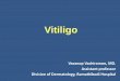 Vitiligo - Mahidol · •When mucosal vitiligo occurs in the context of NSV, it is classified as NSV •Differential diagnosis: lichen sclerosus . Unclassified: focal vitiligo •Acquired,