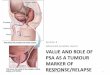 Value and role of PSA as a tumor marker of response/relapse · Oct-14 ESMO preceptorship 3 monitoring risk stratification detection Prostate-specific antigen (PSA) is one of the few