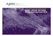 Hip and Knee Replacements - American Joint Replacement ...ajrr.net/images/AJRR_patient_summary_2016_AR_final.pdf · considering hip and knee replacement by collecting and reporting