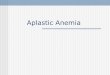 Aplastic Anemia Red Cell Aplasia - HemePath Aplastic Anemia Reduction of ... Aplasia develops by mid