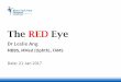 Common Causes - KTPH Red Eye - GP CME 2017.pdf · Common Causes •Allergies •Infections –Ocular – Cornea, uveitis, endophthalmitis –Orbital – Orbital cellulitis •Inflammation