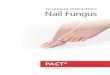 Treatment Instructions Nail Fungus Nail fungus / Stages of the disease Bone Nail margin Nail plate Nail