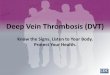 Deep Vein Thrombosis (DVT) · Do You Know About Deep Vein Thrombosis (DVT)? 1 “After my daughter was born, I was all about taking care of her. I didn't know my health could be at