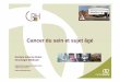 Cancer du sein et sujet âgé - longuevieetautonomie.fr · Oncologie Médicale Hôpital René Huguenin / Institut Curie ... – Husband placed in nursing home – Delayed XRT –
