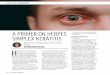 A PRIMER ON HERPES SIMPLEX KERATITIS EPITHELIAL KERATITIS · of keratitis was approximately 32% over 18 months.2 Studies have shown varying recurrence rates, however, ranging between