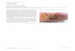 quiz section - unimi.it · quiz section Acta Derm Venereol 2010; 90: 333–335 A 51-year-old man was admitted with an ulcer on the plantar surface of the left foot. The ulcer had
