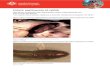 Enteric septicaemia of catfish · Web viewEnteric septicaemia of catfish Also known as infection with Edwardsiella ictaluri, edwardsiellosis and holeinthehead disease From Aquatic