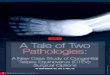 A Tale of Two Pathologies...etiology of CTEV has been presented. In this series, two cases have been presented with the same diagnosis: resistant CTEV. The twist is that these cases