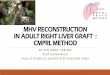 MHV RECONSTRUCTION IN ADULT RIGHT LIVER GRAFT : …doccdn.simplesite.com/d/a8/e9/287104482457151912...mhv reconstruction in adult right liver graft : cmprl method dr. budi irwan ,