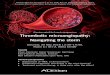 Thrombotic microangiopathy: Navigating the stormWe cordially invite you to the Alexion-sponsored interactive satellite symposium. The objective of this symposium is to create an interactive