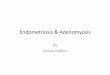 Endometriosis & Adenomyosis - University of Babylon · Serum CAI 25 (Lacks sensitivity) Iridology (a good guess!) DIAGNOSIS fixed fixed uterosacral nodularity. Deeply infiltrating