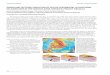 ORIGIN AND TECTONIC EVOLUTION OF ACTIVE CONTINENTAL LITHOSPHERIC DELAMINATION IN … · 2005-06-08 · ACCOMPLISHMENTS 2006 IRIS 5-YEAR PROPOSAL 76 ORIGIN AND TECTONIC EVOLUTION OF