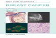Visual Guide for Clinicians BREAST CANCER Breast Cancer...CLINICAL PUBLISHING OXFORD Visual Guide for Clinicians BREAST CANCER Matthew D Barber BSc (Hons), MBChB (Hons), MD, FRCS (Gen