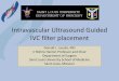Intravascular Ultrasound Guided IVC filter placement Intravascular Ultrasound Guided IVC filter placement