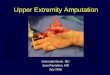 Upper Extremity Amputation Extremity Amputation.pdf · – Partial Hand – Wrist or Forearm – Almost any part in a child . Boulas HJ. ... Solarz MK, Thoder JJ, Rehman S. Management