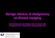 Benign Mimics of Malignancy on Breast Imaging · 2015-09-26 · women of reproductive age. • There is no associated risk of ... especially in larger lesions. – MRI • T2 iso